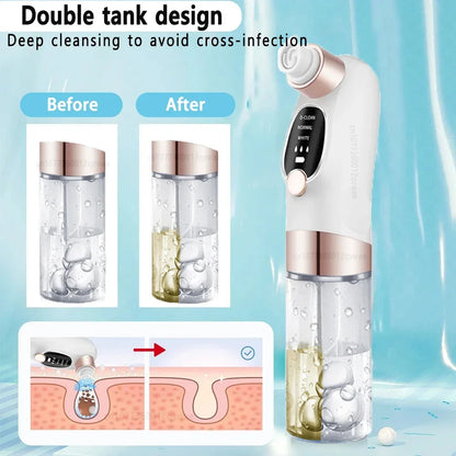 Aspirateur Électrique Points Noirs — Nettoyeur de Pores avec Cycle d'Eau, Rechargeable USB