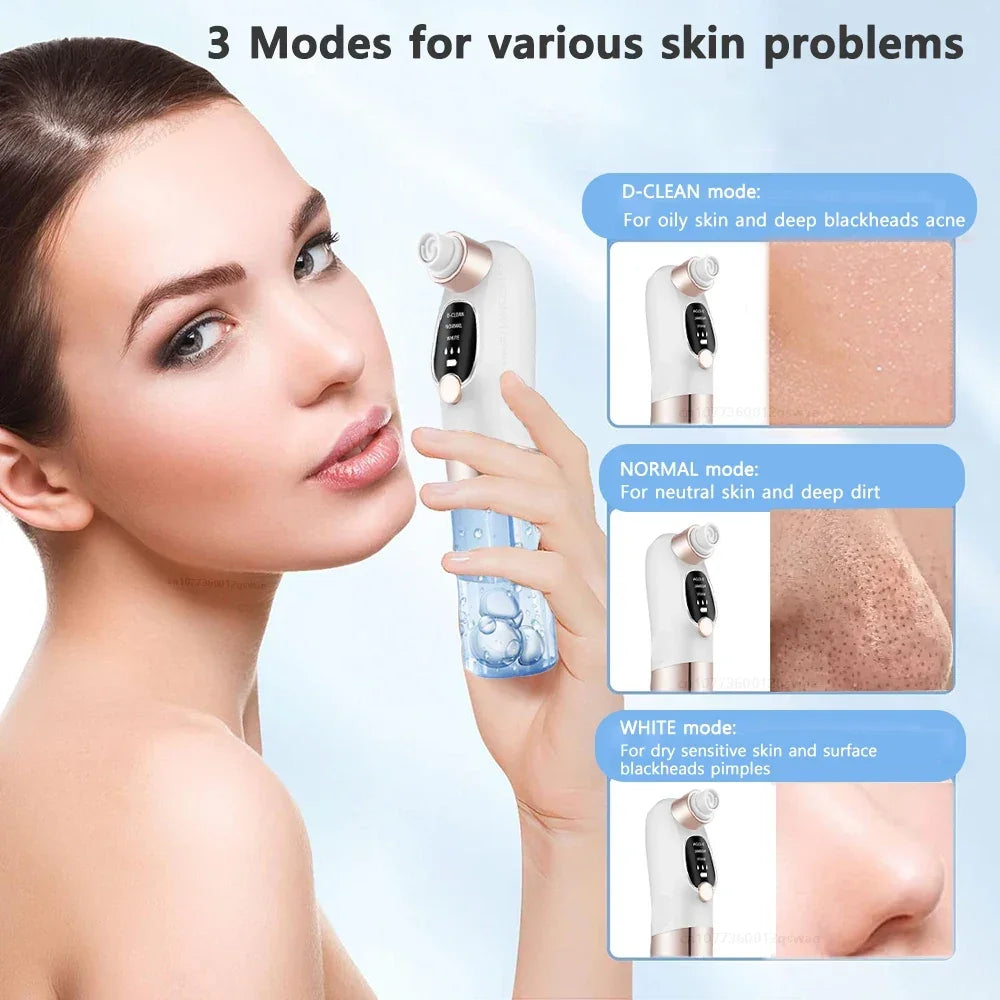 Aspirateur Électrique Points Noirs — Nettoyeur de Pores avec Cycle d'Eau, Rechargeable USB