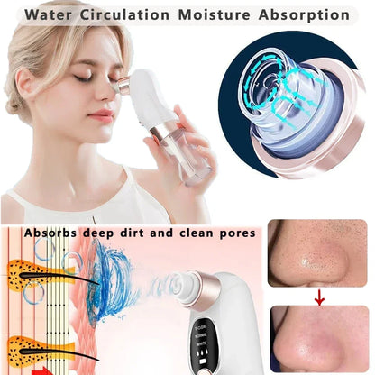 Aspirateur Électrique Points Noirs — Nettoyeur de Pores avec Cycle d'Eau, Rechargeable USB