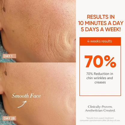 Masque LED Facial — Thérapie Lumineuse Anti-Acné & Rajeunissement